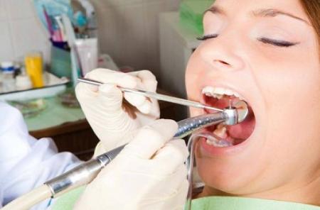 دندانپزشکان به دلار از بیماران پول می‌گیرند!/  ایمپلنت 56 میلیون تومانی در تهران