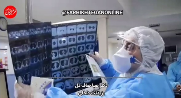 یک هشدار جدی درباره آسیب‌های ریوی کرونا