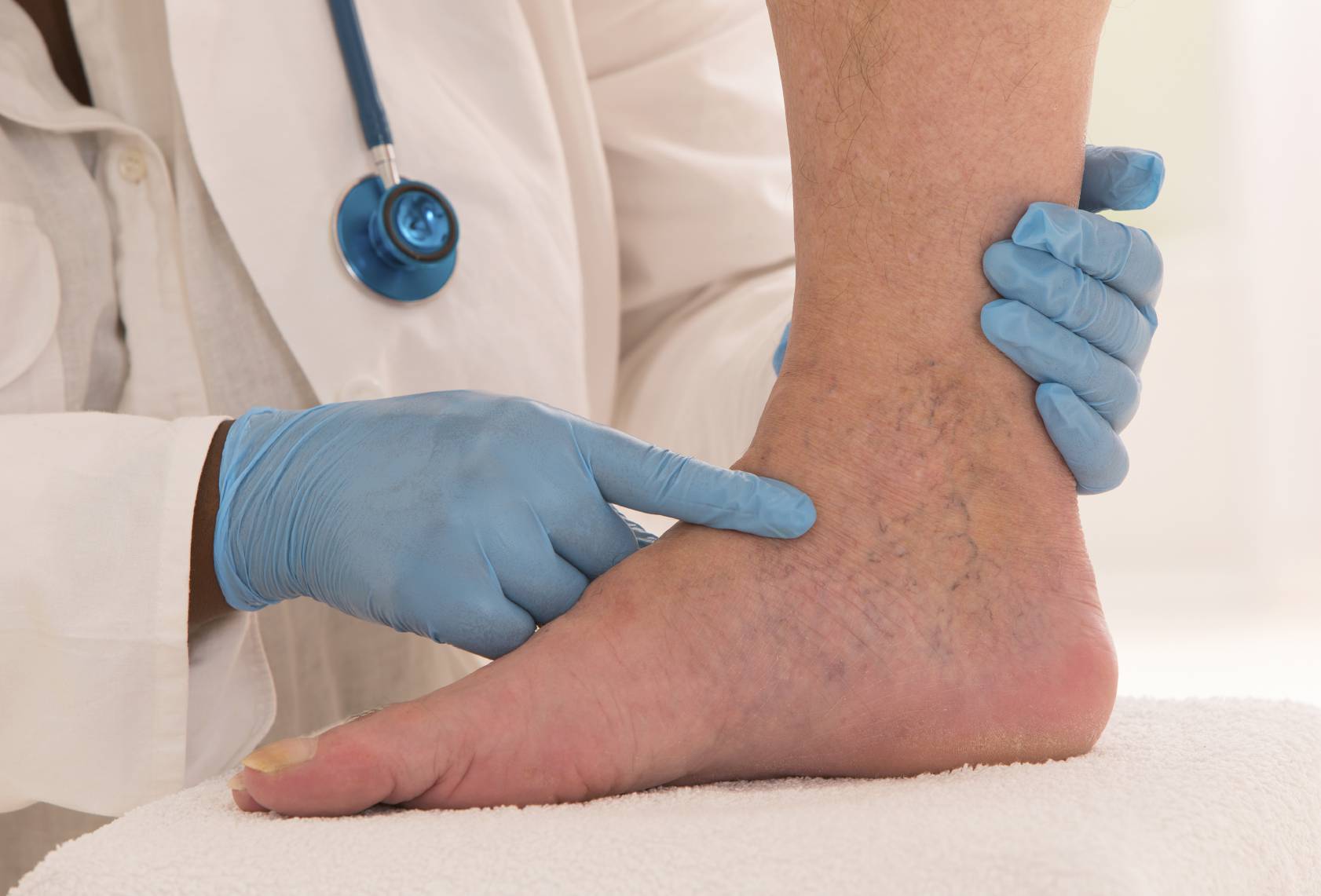 علت‌ها و روش‌های درمانی گرفتگی عضلات پا در خواب و افتادگی مچ پا