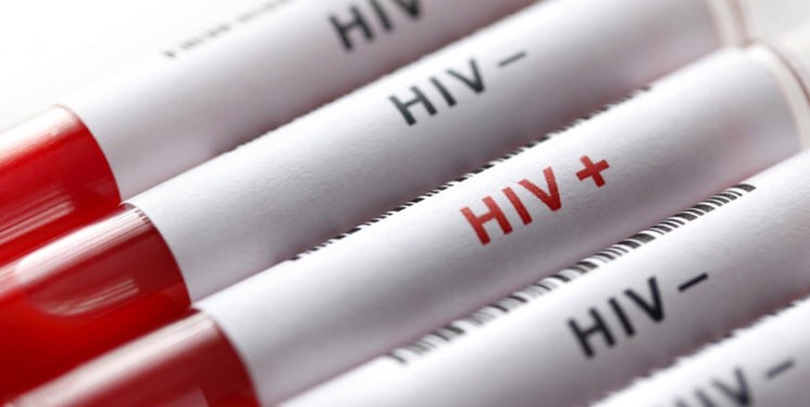 آخرین آمار شیوع ایدز در کشور
