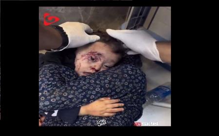 کودک مجروح فلسطینی در آغوش مادر + فیلم