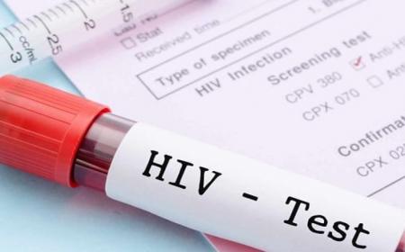 ۴۶ هزار مبتلای زنده به HIV در کشور داریم
