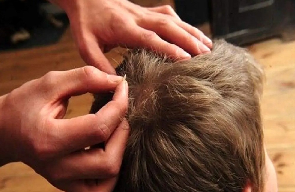 مدارس ایران به خاطر شپش تعطیل میشوند؟