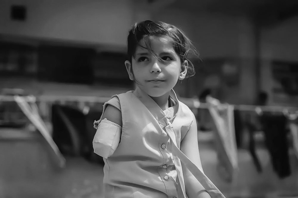 غزه؛ پایتخت جهانی کودکان قطع عضو