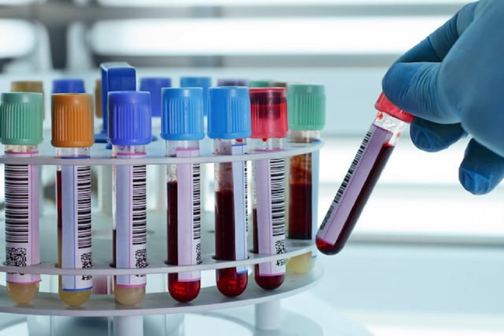 هشدار درباره تجویز آزمایشهای بیمورد در حوزه درمان