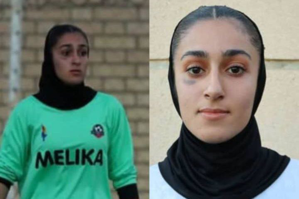 کبودی زیر چشم و درگیری عجیب در فوتبال بانوان