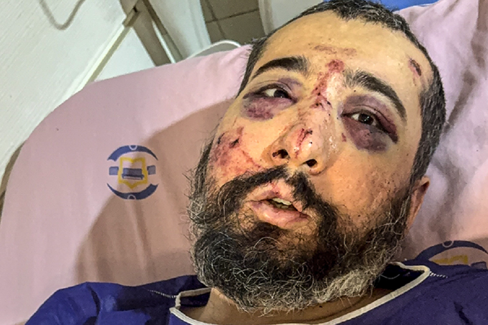 خشونت مرز نمیشناسد اما روایتها چرا